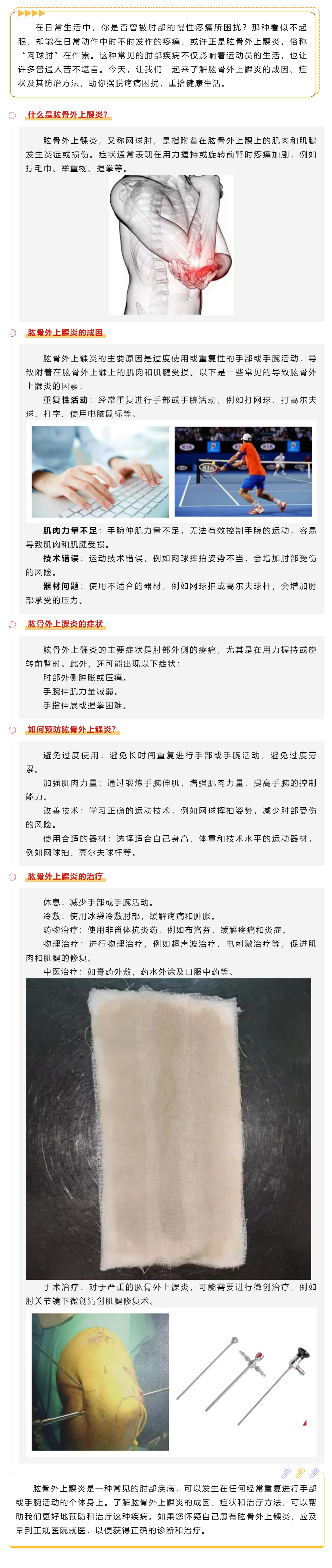 揭秘肘部隱痛之謎——認識肱骨外上髁炎.png