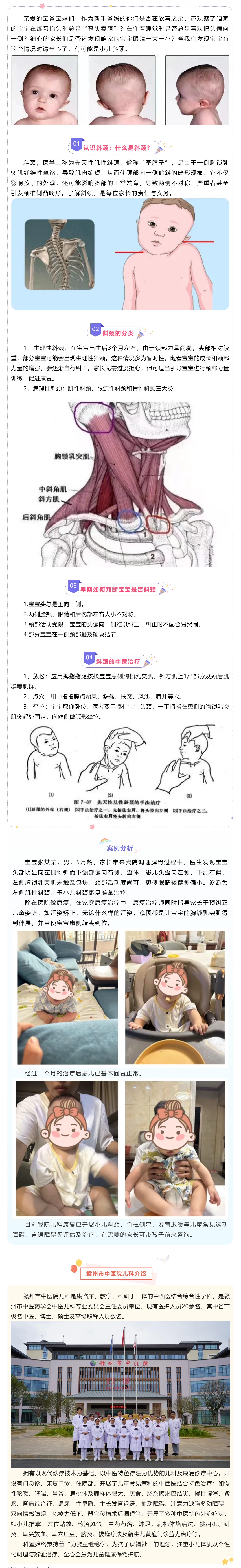 【科普】小兒歪頭“賣萌”？不，還有可能是斜頸.png